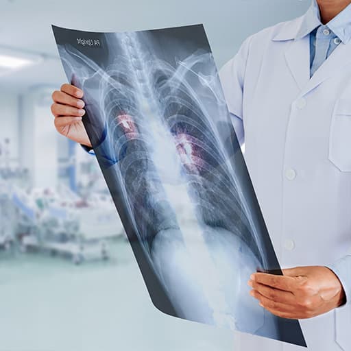 X-ray